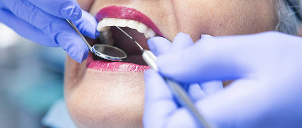 Best Emergency Cosmetic Dentistry in Clifton Springs, NY
